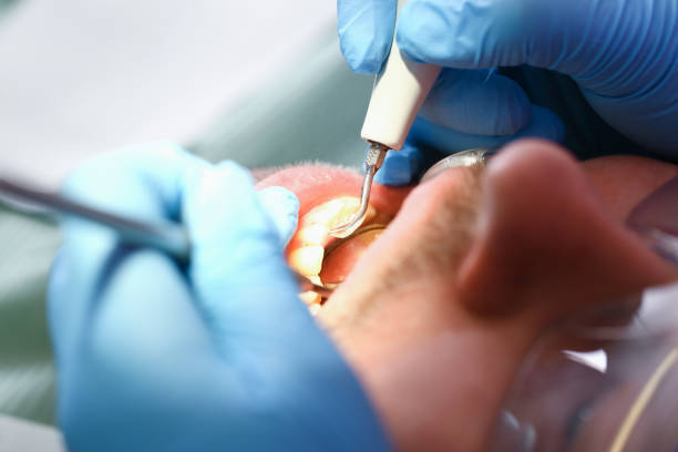 Best Emergency Dental Services for Seniors in Macom, IL