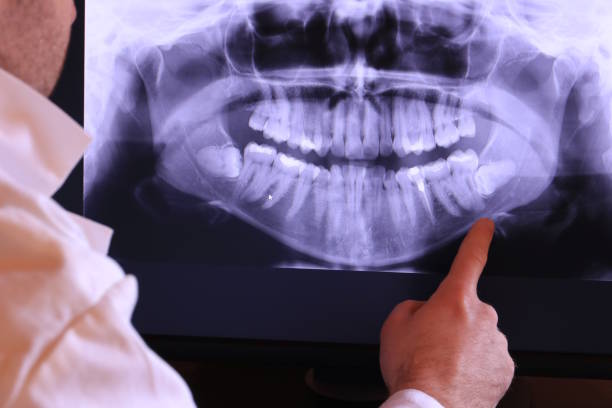 Best Emergency Dental Extractions in Macom, IL