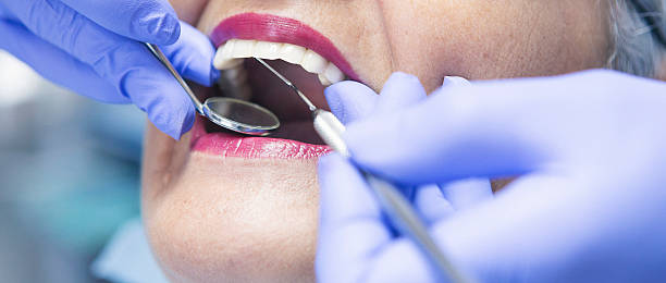 Best Emergency Root Canal Treatment in Macom, IL