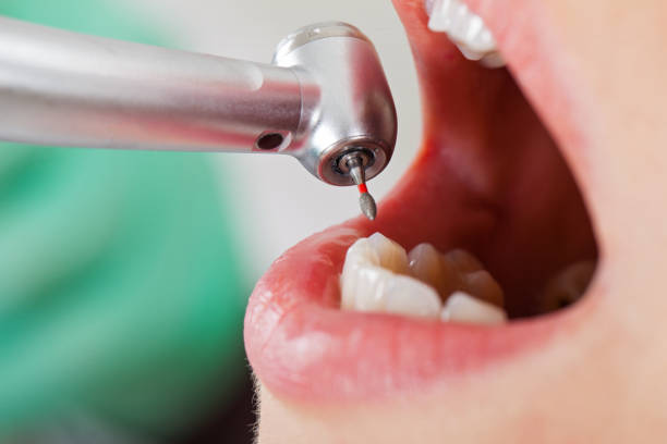 Best Broken or Cracked Tooth Emergency Dentist in Macom, IL